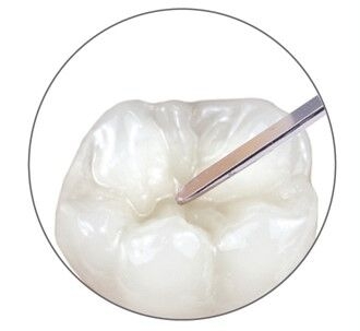 CeramX Spectra ST Zahnmodellation