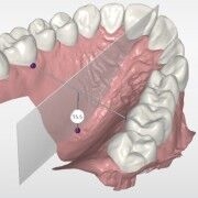 CEREC Ortho SW 2.1