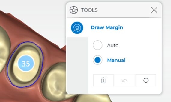 Draw Preparation Margin, CEREC SW 5.1