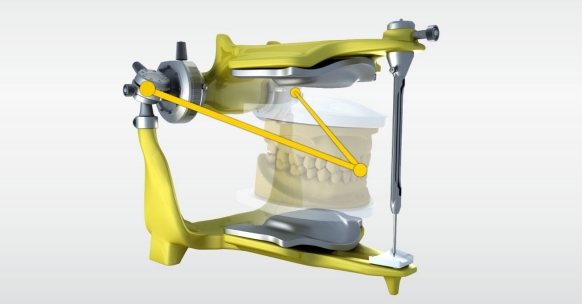 Full Range Dynamic Occlusion
