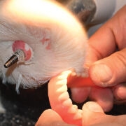 finish 3d printed denture fabrication