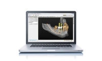 Simplant- Guided surgery