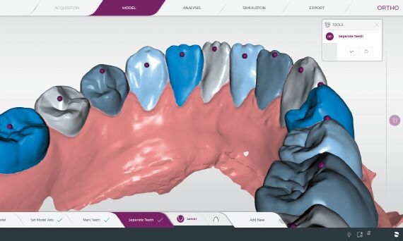 CEREC Ortho Segmentación de modelo