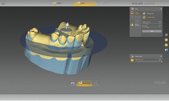 inLab CAD Software, undercuts of a model are visualized