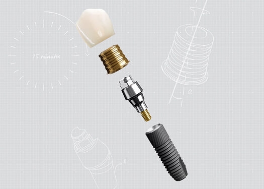 Dentsply Sirona Implants - Acuris