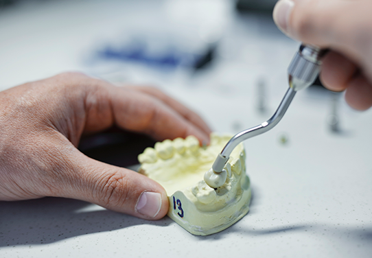 Dentsply Sirona Implants News and Insights