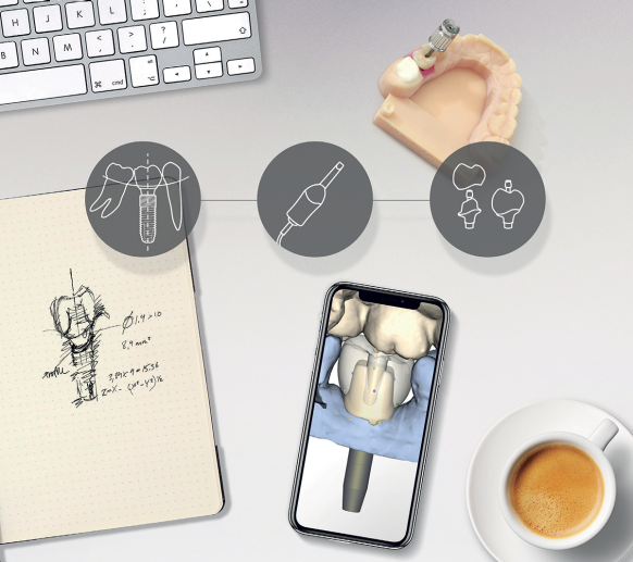 Dentsply Sirona Implants News and Insights