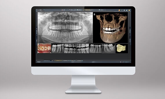 Sidexis 4 imaging software with lightbox